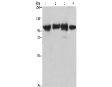 兔抗ACTN4多克隆抗体