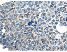 兔抗CLSTN1多克隆抗体