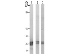 兔抗TNFSF12多克隆抗体