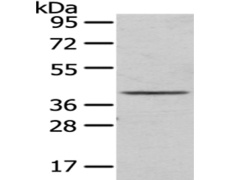 兔抗TOR1A多克隆抗体
