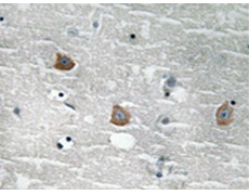 兔抗TOB1(Phospho-Ser164) 多克隆抗体