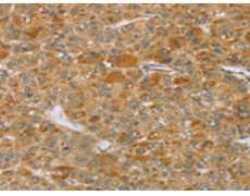 兔抗TP53I11多克隆抗体