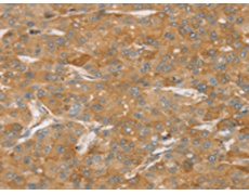 兔抗TPD52L2多克隆抗体