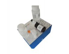 钙检测试剂盒(邻甲酚酞络合酮比色法/50T)